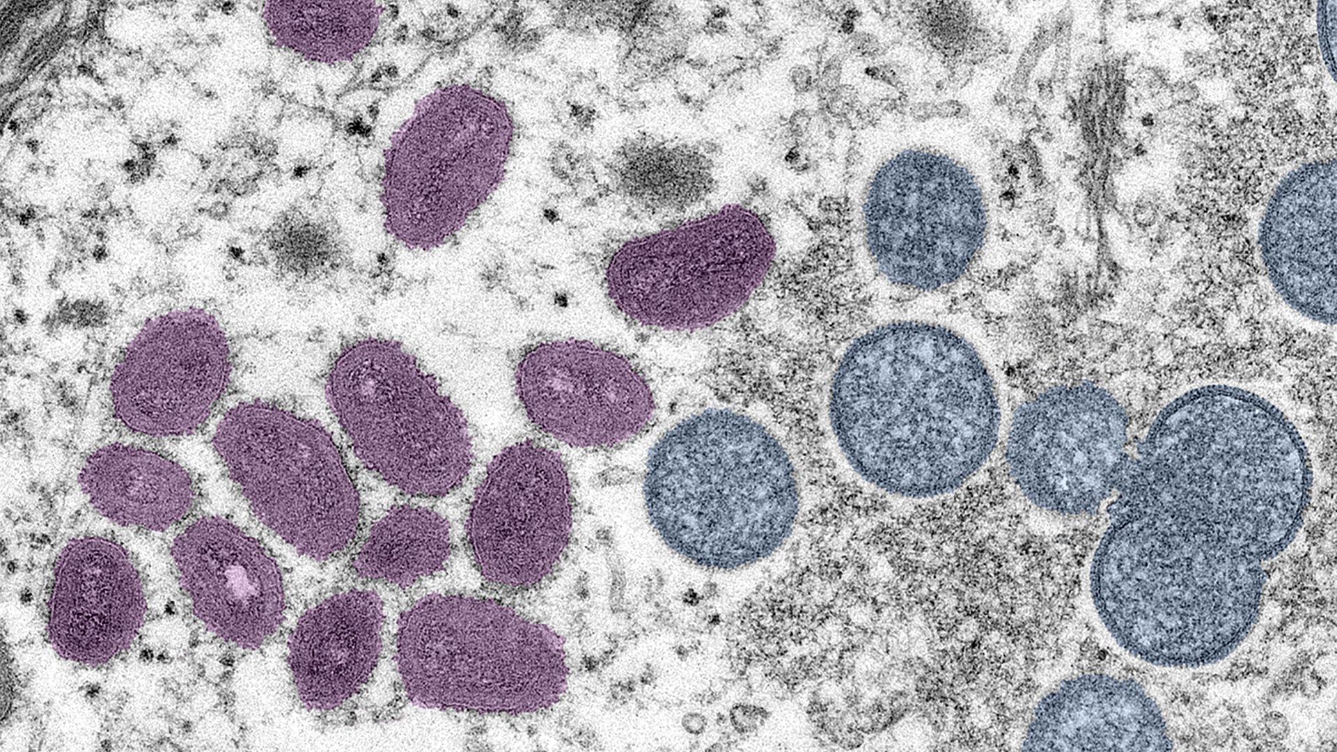 A microscopic image depicting a monkeypox virus particle published on June 6.